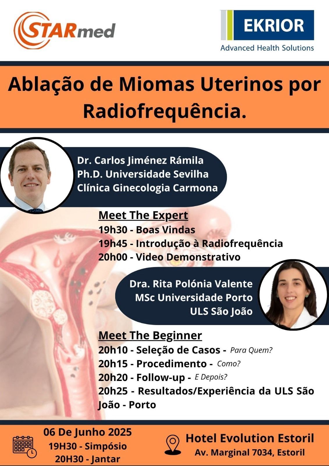 EKRIOR no XVI Congresso da SPG: inovação com radiofrequência no tratamento dos miomas uterinos