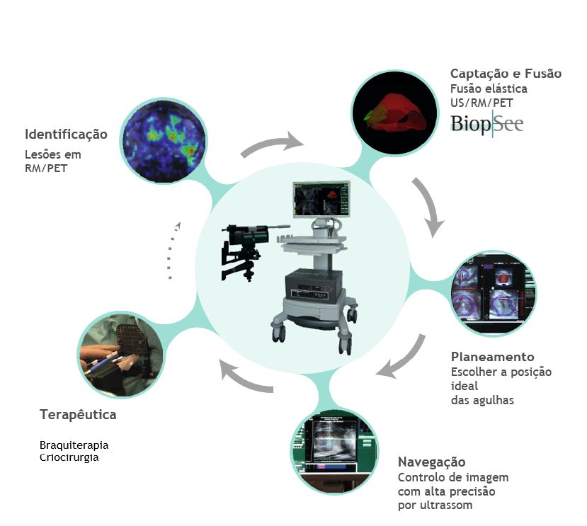EKRIOR no 1.º Congresso da Sociedade Portuguesa de Urologia Oncológica (SPUO)